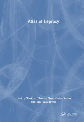 Vasudevan / Neema / Rathod |  Atlas of Leprosy | Buch |  Sack Fachmedien