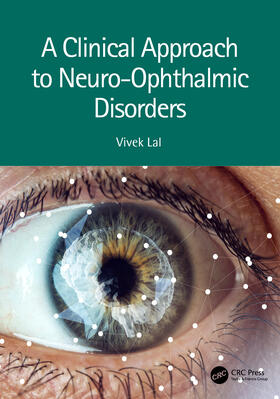 Lal |  A Clinical Approach to Neuro-Ophthalmic Disorders | Buch |  Sack Fachmedien