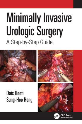 Hooti / Hong |  Minimally Invasive Urologic Surgery | Buch |  Sack Fachmedien