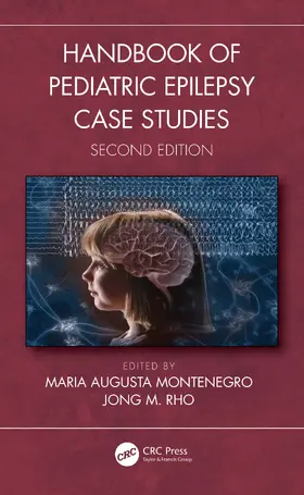 Rho / Montenegro |  Handbook of Pediatric Epilepsy Case Studies, Second Edition | Buch |  Sack Fachmedien