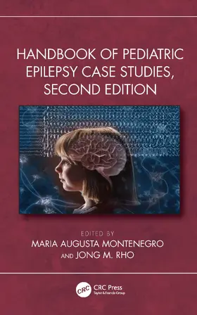 Montenegro / Rho |  Handbook of Pediatric Epilepsy Case Studies | Buch |  Sack Fachmedien