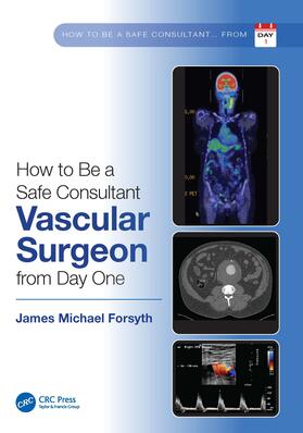 Forsyth |  How to be a Safe Consultant Vascular Surgeon from Day One | Buch |  Sack Fachmedien