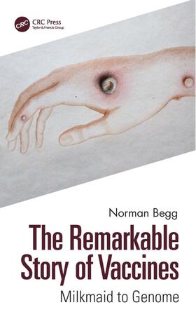 Begg |  The Remarkable Story of Vaccines | Buch |  Sack Fachmedien