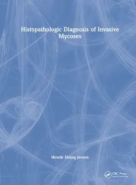 Jensen |  Histopathologic Diagnosis of Invasive Mycoses | Buch |  Sack Fachmedien