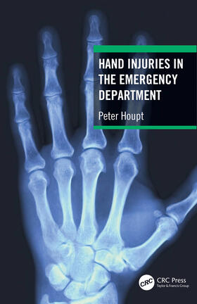 Houpt |  Hand Injuries in the Emergency Department | Buch |  Sack Fachmedien