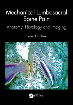 Giles |  Mechanical Lumbosacral Spine Pain | Buch |  Sack Fachmedien