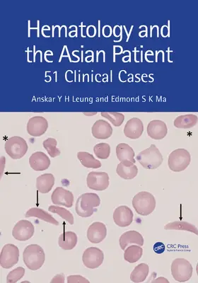 Leung / Ma |  Haematology and the Asian Patient | Buch |  Sack Fachmedien