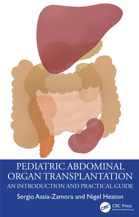 Heaton / Assia-Zamora |  Pediatric Abdominal Organ Transplantation | Buch |  Sack Fachmedien