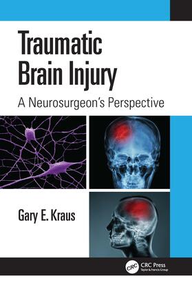 Kraus |  Traumatic Brain Injury: A Neurosurgeon's Perspective | Buch |  Sack Fachmedien