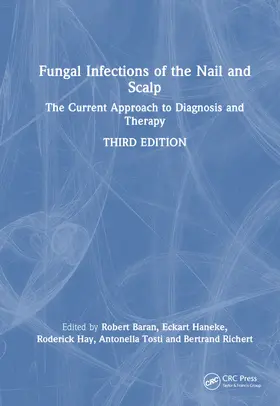 Tosti / Baran / Richert-Baran |  Fungal Infections of the Nail and Scalp | Buch |  Sack Fachmedien