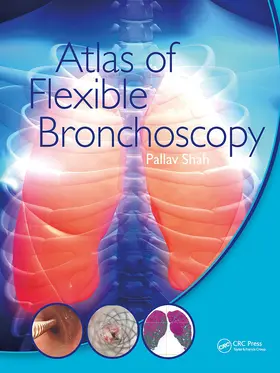 Shah |  Atlas of Flexible Bronchoscopy | Buch |  Sack Fachmedien