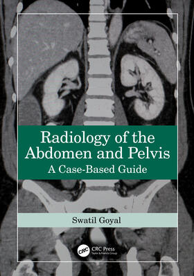 Goyal |  Radiology of the Abdomen and Pelvis | Buch |  Sack Fachmedien