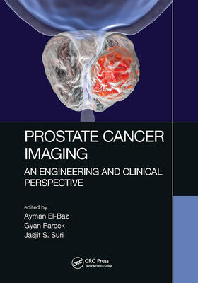 El-Baz / Pareek / Suri |  Prostate Cancer Imaging | Buch |  Sack Fachmedien