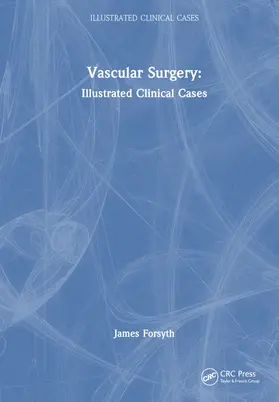 Forsyth |  Vascular Surgery | Buch |  Sack Fachmedien