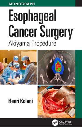 Kolani |  Esophageal Cancer Surgery | Buch |  Sack Fachmedien