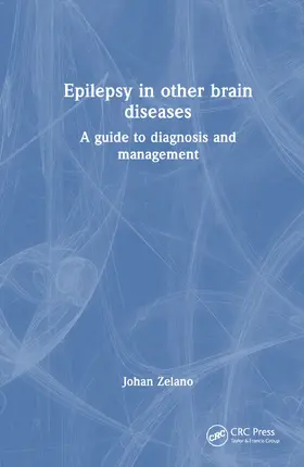 Zelano |  Epilepsy in Other Brain Diseases | Buch |  Sack Fachmedien