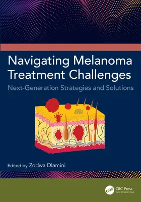 Dlamini |  Navigating Melanoma Treatment Challenges | Buch |  Sack Fachmedien