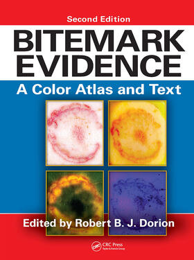 Dorion |  Bitemark Evidence | Buch |  Sack Fachmedien