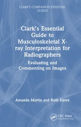 Martin |  Clark's Essential Guide to Musculoskeletal X-ray Interpretation for Radiographers | Buch |  Sack Fachmedien