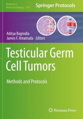 Amatruda / Bagrodia |  Testicular Germ Cell Tumors | Buch |  Sack Fachmedien