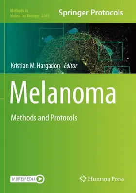 Hargadon |  Melanoma | Buch |  Sack Fachmedien