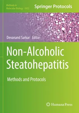 Sarkar |  Non-Alcoholic Steatohepatitis | Buch |  Sack Fachmedien