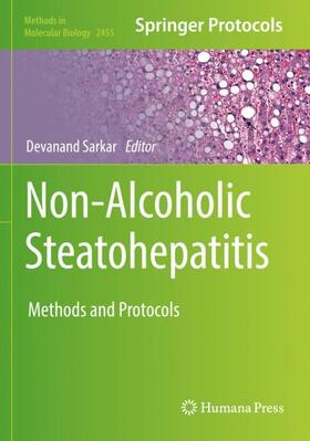 Sarkar |  Non-Alcoholic Steatohepatitis | Buch |  Sack Fachmedien