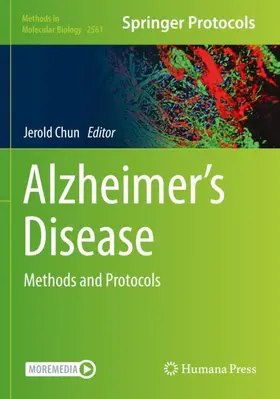 Chun |  Alzheimer's Disease | Buch |  Sack Fachmedien