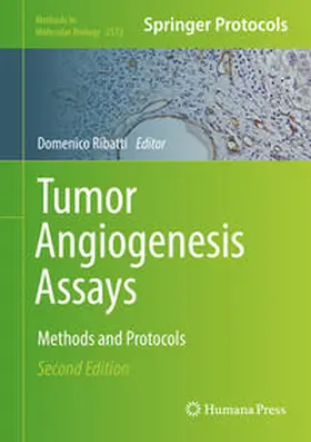 Ribatti |  Tumor Angiogenesis Assays | eBook | Sack Fachmedien