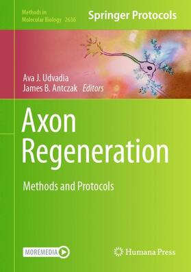 Antczak / Udvadia |  Axon Regeneration | Buch |  Sack Fachmedien