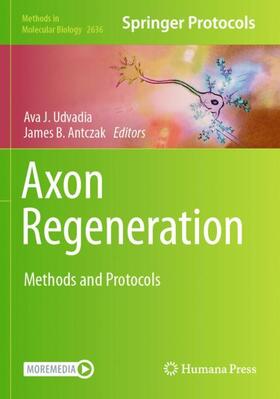Antczak / Udvadia |  Axon Regeneration | Buch |  Sack Fachmedien