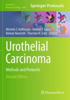 Hoffmann / Ecke / Gaisa |  Urothelial Carcinoma | Buch |  Sack Fachmedien