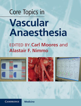 Moores / Nimmo |  Core Topics in Vascular Anaesthesia | Buch |  Sack Fachmedien