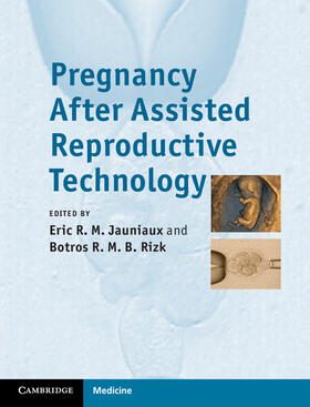 Jauniaux / Rizk |  Pregnancy After Assisted Reproductive Technology | Buch |  Sack Fachmedien