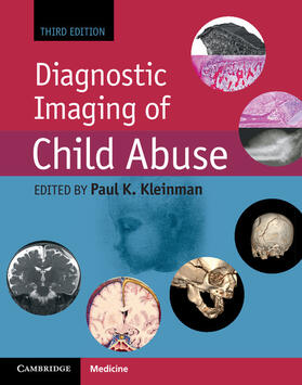 Kleinman |  Diagnostic Imaging of Child Abuse | Buch |  Sack Fachmedien