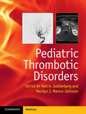 Goldenberg / Manco-Johnson |  Pediatric Thrombotic Disorders | Buch |  Sack Fachmedien