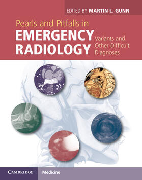 Gunn |  Pearls and Pitfalls in Emergency Radiology | Buch |  Sack Fachmedien