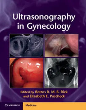 Rizk / Puscheck |  Ultrasonography in Gynecology | Buch |  Sack Fachmedien