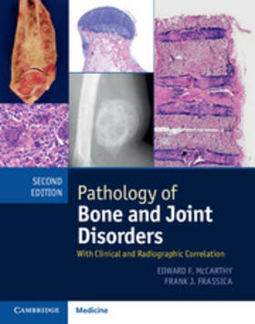 McCarthy / Frassica |  Pathology of Bone and Joint Disorders Print and Online Bundle | Buch |  Sack Fachmedien