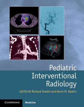 Towbin / Baskin |  Pediatric Interventional Radiology | Buch |  Sack Fachmedien