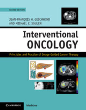 Geschwind / Soulen |  Interventional Oncology | Buch |  Sack Fachmedien