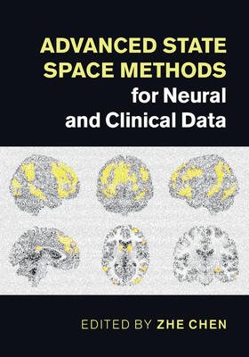 Chen |  Advanced State Space Methods for Neural and Clinical Data | Buch |  Sack Fachmedien