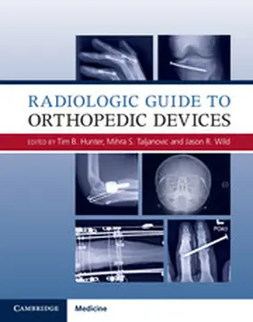 Hunter / Taljanovic / Wild |  Radiologic Guide to Orthopedic Devices | Buch |  Sack Fachmedien