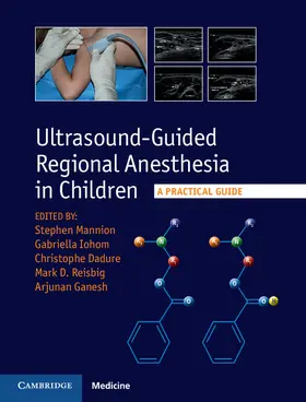 Mannion / Iohom / Dadure |  Ultrasound-Guided Regional Anesthesia in Children | Buch |  Sack Fachmedien