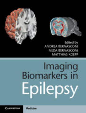 Bernasconi / Koepp |  Imaging Biomarkers in Epilepsy | Buch |  Sack Fachmedien