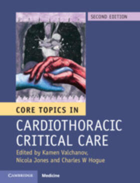 Valchanov / Jones / Hogue |  Core Topics in Cardiothoracic Critical Care | Buch |  Sack Fachmedien