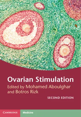 Aboulghar / Rizk |  Ovarian Stimulation | Buch |  Sack Fachmedien