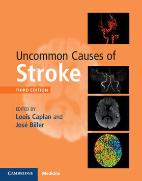 Caplan / Biller |  Uncommon Causes of Stroke | Buch |  Sack Fachmedien