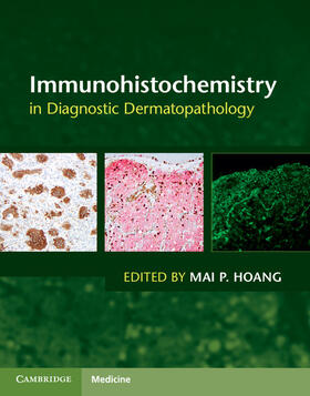 Hoang |  Immunohistochemistry in Diagnostic Dermatopathology | Buch |  Sack Fachmedien