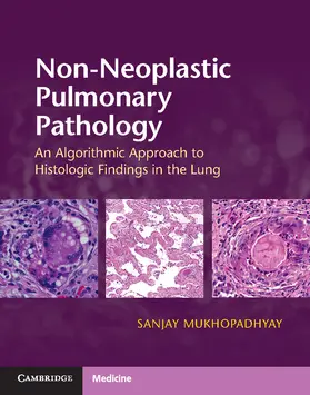 Mukhopadhyay |  Non-Neoplastic Pulmonary Pathology with Online Resource | Buch |  Sack Fachmedien